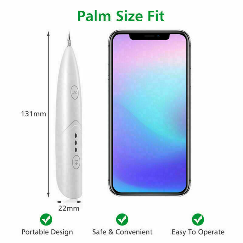 Ion Laser Freckle Skin Mole Dark Spot Remover Face Wart Tag Tattoo Removal Pen Mostore.com