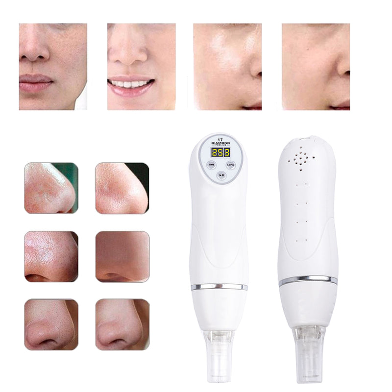 Portable Digital Microdermabrasion Diamond Dermabrasion Pen Vacuum Massage Skin Peeling Beauty Equipment Mostore.com