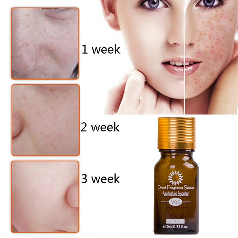 Dredge Meridian Skin Care Natural Pure Removal Acne Stretch Marks Scar Removal Essence oil Mostore.com
