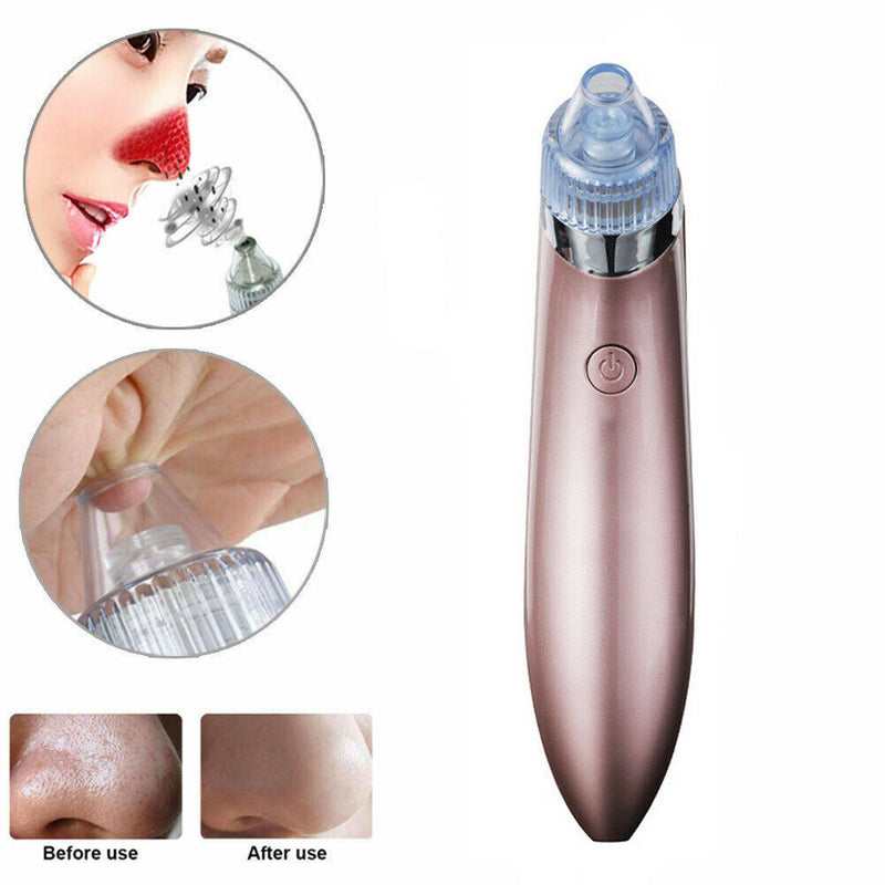 Electric Blackhead Vacuum Pore Cleaner Acne Pimple Remover Strong Suction Tool Electric Blackhead Remover Pore Vacuum Suction Diamond Dermabrasion Face Cleaner Mostore.com