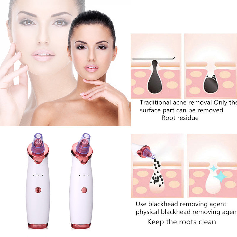 Blackhead Remover Instrument Black Dot Remover Acne Vacuum Suction Face Clean Black Head Pore Cleaning Beauty Skin Care Tool Mostore.com