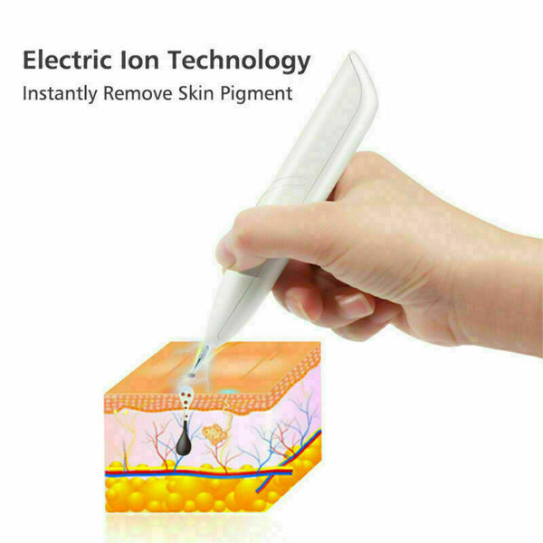 Ion Laser Freckle Skin Mole Dark Spot Remover Face Wart Tag Tattoo Removal Pen Mostore.com