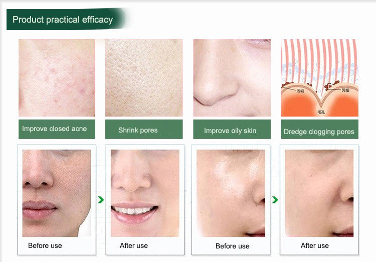 Portable Digital Microdermabrasion Diamond Dermabrasion Pen Vacuum Massage Skin Peeling Beauty Equipment Mostore.com