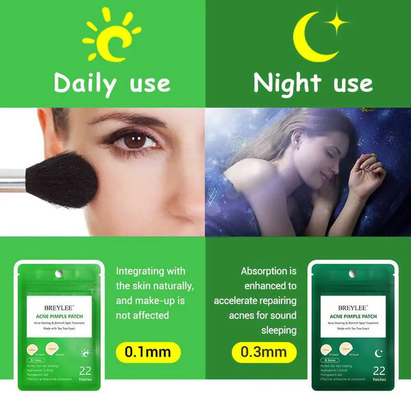 Tea Tree Acne Patch Fades Acne Marks and Ultra-thin Mostore.com