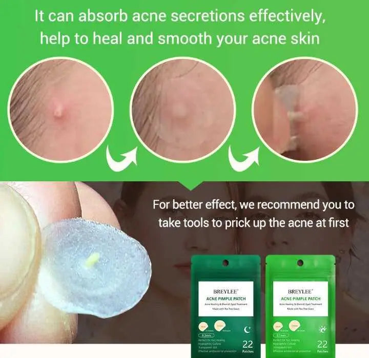 Tea Tree Acne Patch Fades Acne Marks and Ultra-thin Mostore.com
