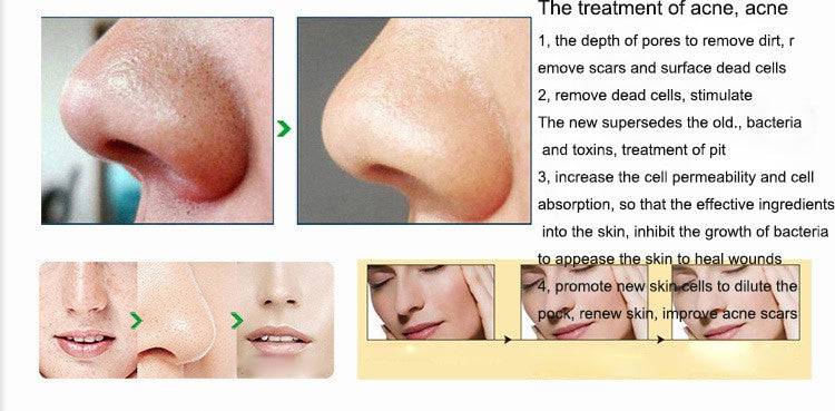 Portable Digital Microdermabrasion Diamond Dermabrasion Pen Vacuum Massage Skin Peeling Beauty Equipment Mostore.com