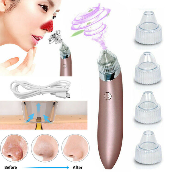 Electric Blackhead Vacuum Pore Cleaner Acne Pimple Remover Strong Suction Tool Electric Blackhead Remover Pore Vacuum Suction Diamond Dermabrasion Face Cleaner Mostore.com