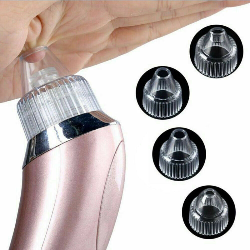 Electric Blackhead Vacuum Pore Cleaner Acne Pimple Remover Strong Suction Tool Electric Blackhead Remover Pore Vacuum Suction Diamond Dermabrasion Face Cleaner Mostore.com