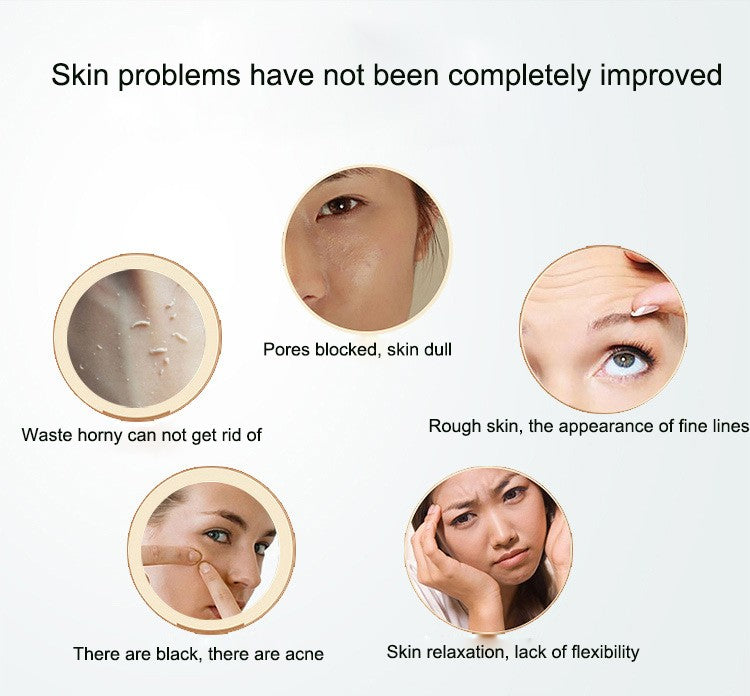 Portable Digital Microdermabrasion Diamond Dermabrasion Pen Vacuum Massage Skin Peeling Beauty Equipment Mostore.com